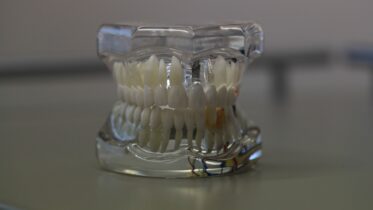 Proteza zębowa czyli sztuczne zęby